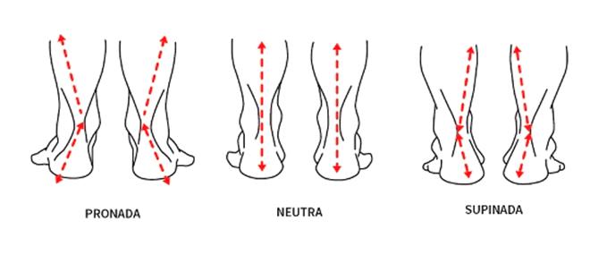 Imagem ilustrativa mostrando os tipos de pisada possíveis.